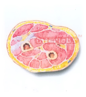 HUMAN TRANSVERSE SECTION MODEL THROUGH THE MIDDLE 1/3 OF RIGHT FOREARM (B)